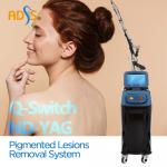 Carbon Peel ND YAG Laser Machine 532nm 1064nm For Skin Rejuvenation for sale