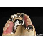 Elaborate Framework Final Set Stable Dental Structure Designed Teeth Finish for sale
