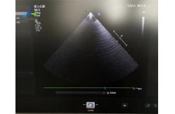 China GE S8-3 Ultrasound Probe Transducer Maintenance Image With Error supplier