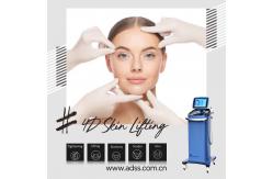 China RF Skin Tightening Face Lifting Machine , Fractional RF Beauty Machine supplier
