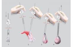 China Laparoscopic Surgery 10mm Endobag Specimen Retrieval supplier