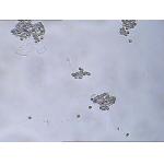 MAR IgA Test Kit IgA Antibody Coating Spermatozoa MAR Sperm Function Test Kit for sale