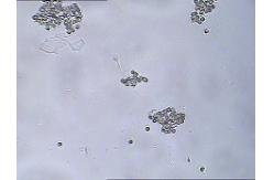 China MAR IgA Test Kit IgA Antibody Coating Spermatozoa MAR Sperm Function Test Kit supplier