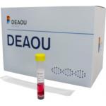 Latest Rapid Test Kit Rapid Diagnostic Kit Transport Medium Ce Certified for sale