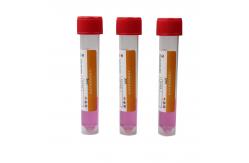 China 10ML Hospital Tools And Equipments Viral Virus Sampling Specimen Collection Tube supplier