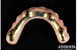 China Functionality Ti-Bar Compatible With Natural Teeth And Gums Restores Chewing Function supplier