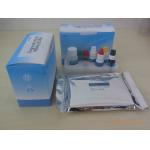 Ce Approved Hbsag Elisa Kit Medical Diagnostic Device for sale