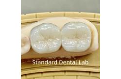 China Dental Lab Crowns Translucent Full Contour Zirconia With Superior Strength supplier