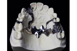 China Cr Co Partial Denture Metal Framework supplier
