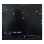 All Probe Images No Echo Ultrasound machine Repair System Aloka ARIETTA 70 for sale