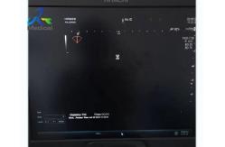 China All Probe Images No Echo Ultrasound machine Repair System Aloka ARIETTA 70 supplier