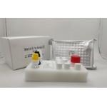 Serum Plasma Diagnostic Test Igg Elisa Kit For Hepatitis B Core Antigen for sale