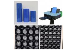 China PET Base Blue Medical Inkjet Film With High Image Stability With High Resolution supplier