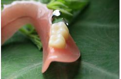 China Partial Removable Acrylic Partial Denture supplier