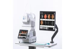 China Autoexposure Automated Fundus Camera FFA Non Mydriatic supplier