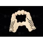 Milled Peek Framework Customizable Digital Partial Dentures Superior Thin