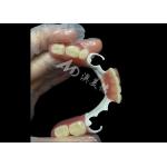 Custom Made Durable Cast Partial Dentures With Hpp Framework For Restoring Your Smile for sale