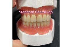 China Full Upper And Lower Stayplate Acrylic Partial Dentures Ivoclar Teeth Pink Gum supplier