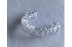China Custom Made Mandibular Arch Stablizing Bite Splint supplier