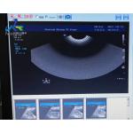  HD15 Ultrasound Machine Repair Blood Flow Interference Replace ACB Board