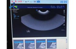 China  HD15 Ultrasound Machine Repair Blood Flow Interference Replace ACB Board supplier