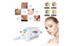 China FDA 5NS Q Switched Nd Yag Laser Tattoo Removal supplier