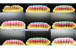 China Dental PFM Crown manufacturer
