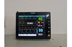 China Portable Multi Parameter Patient Monitor for vet supplier