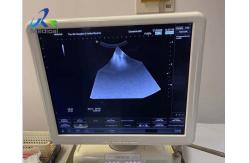 China Hitachi Aloka Ascendus Image Missing Ultrasound Machine Repair Replace TRX Board supplier