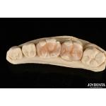 Natural Polymerized Porcelain Dental Inlay Onlay For Tooth Restoration for sale