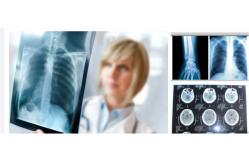 China Blue White X Ray Film  for Accurate Diagnostic Imaging supplier