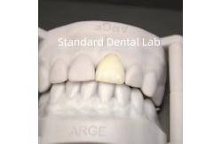 China Digital CAD CAM Dental Lab Crowns Translucent Layered Zirconia Crown supplier