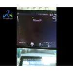 GE Voluson E8 Ultrasound Machine Repair Abnormal Ultrasound Images Replace Rfm Board