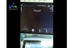China GE Voluson E8 Ultrasound Machine Repair Abnormal Ultrasound Images Replace Rfm Board supplier