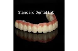 China Esthetic Monolithic Porcelain Zirconia Crown Full Arch Translucency supplier