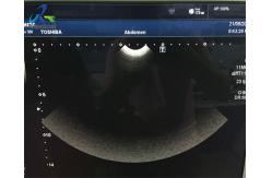 China PVT-712BT 11MC4 Micro Convex Ultrasound Probe 10.2MHz For Neonatal Head supplier