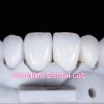 Natural Looking Restorations Aidite Dental Zirconia Tooth Crown for sale