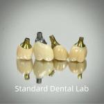 Professional Zirconia Screw Retained Implant Crown Titanium CAD CAM for sale