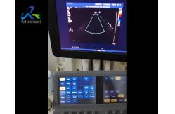 China IE ELITE Ultrasound Machine Repair Control Panel Patient Supplies supplier