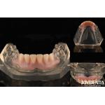 Tooth Arrangement Technology Flexible Denture Finish High Elasticity Customization for sale