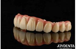 China Adjustable Titanium Malong Hybrid Bridge Perfect Combination Of Traditional And Modern Techniques supplier