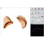 Meridian Test Metatron Nls 4025 Hunter Body Analyzer Health Diagnostic Machine