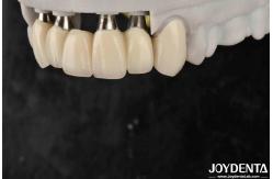 China Customizable Implant Crown And Bridge For Safe Oral Biocompatibility supplier