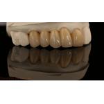 Noritake Porcelian Full Contour Zirconia Crown High Aesthetic Natural Customized Zirconia Dental Bridge for sale