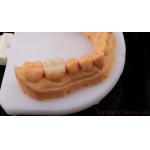 Translucency Zirconia Dental Inlay Onlay Crown For Restore Natural Cavity Shape / Standard Dental Lab for sale