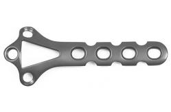 China Upper Limbs Distal Radius Plates Titanium Plate And Screw supplier