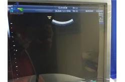 China Gynecological Used Curved Probe Ultrasound Logiq E9 System supplier