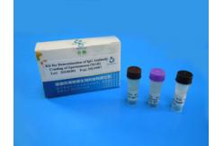 China SpermFunc Male Fertility Test Kit For Determination IgG Antibody Coating Spermatozoa supplier