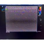  HD15 Ultrasound Machine Repair Blood Flow Interference Replace ACB Board