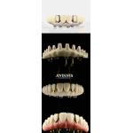 Dental Aesthetic Titanium Malong Hybrid Bridge Ultimate Solution For Dental Restorations for sale